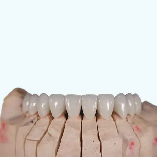 hector 1100MPa multiayer zirconia